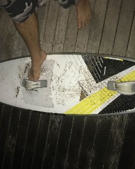 Are these straps facing the right way?