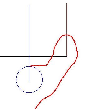 Suicide leash setup