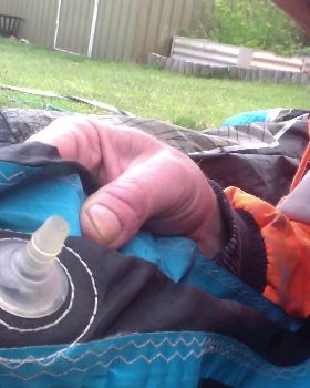 Repair/New bladder