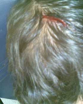 Leash Accident, The entrance