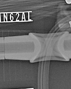 X-Ray shot