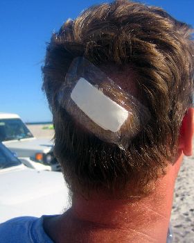 After Kitestock