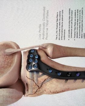Injury