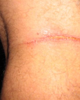 Legs vs lines!!  Not cool!!
