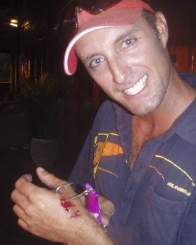 Danos fishing injury