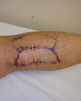 A shark bite would have been less life threatening