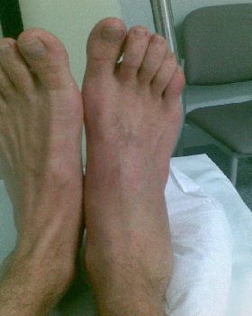 sams foot