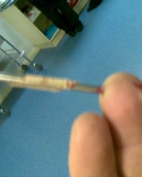 NAIL
