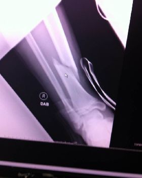 photo 1.JPG leg