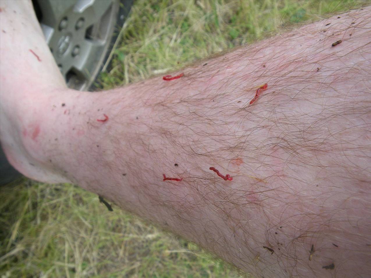 red worms crawling out of my skin
