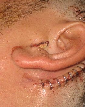 My ear