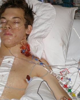 My trip to Melbourne for surgery