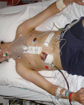 My trip to Melbourne for surgery