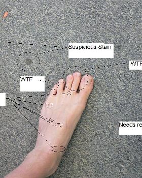Foot1