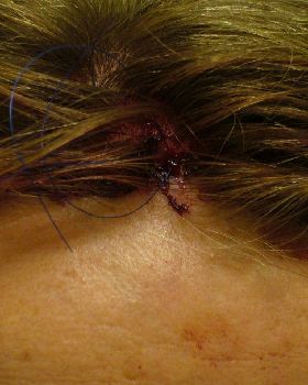 My contribution of accident pics