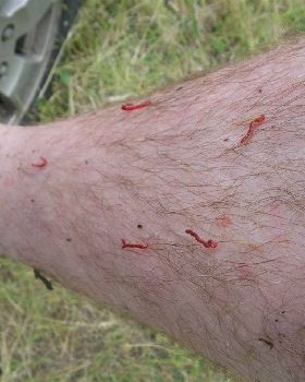 red worms crawling out of my skin