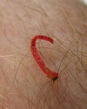 red worms crawling out of my skin