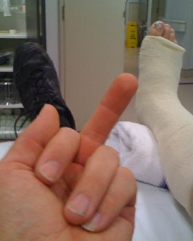 Foot stuck in strap in wipeout