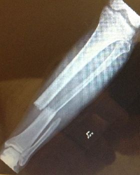 ouch..