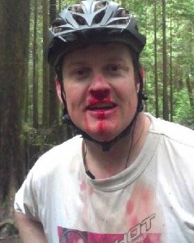 Face Plant