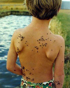 WA Flies