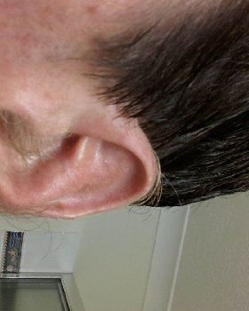 ear hair