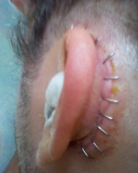 OUCH !!!!!!!!!