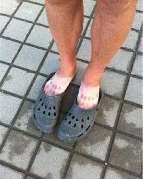 crocs