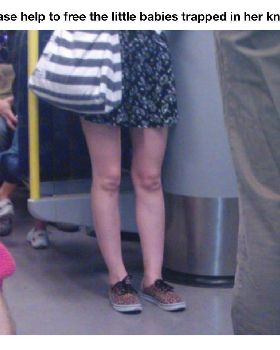 baBY KNEES