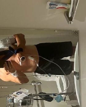Shoulder 1
