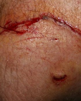 Elbow Slice