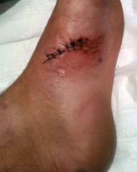 foot