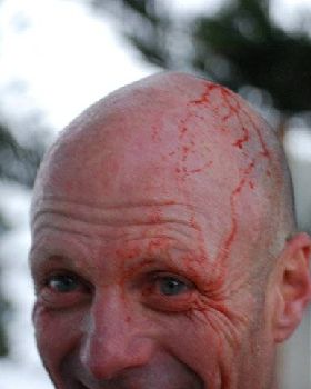 Al Bradley Hail Damage