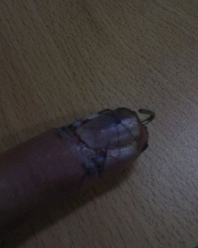 leg rope injury