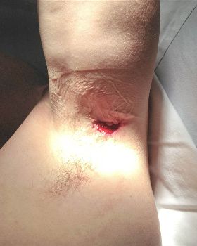 gash 1