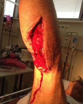 Gash if the week