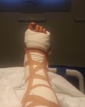 Foot