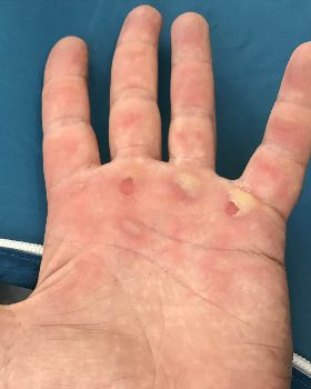 hand1