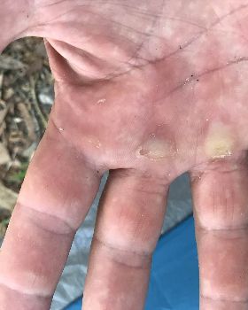 hand1
