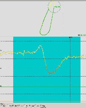 Decreps 4jan lilacs alpha