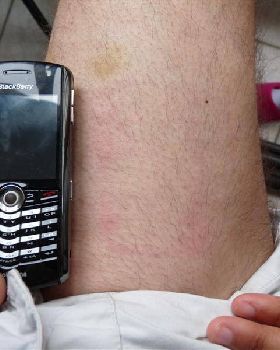 Breaking a mast and a Blackberry
