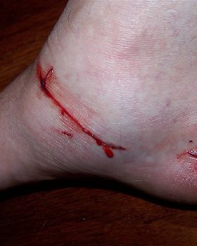 Fin Damage