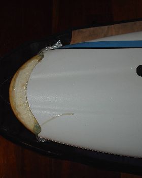 classic nose remodel 1