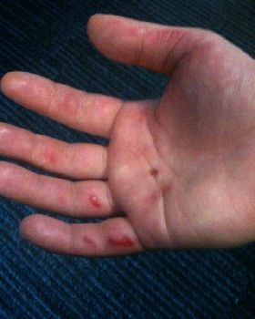 Windsurfer Hands