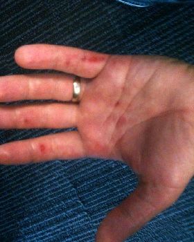 Windsurfer Hands