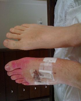 Foot