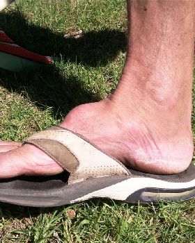 Deanos Foot
