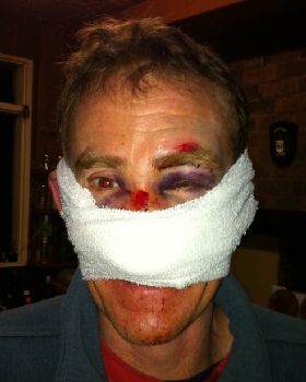 Peters Crash Face