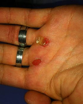 hand1