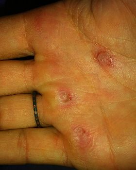 hand2